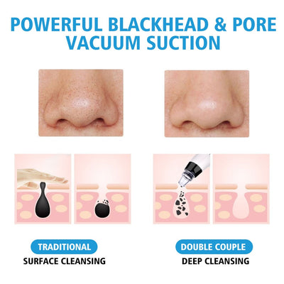 Blackhead Vacuum Pore Electric Cleaner