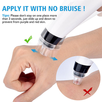 Blackhead Vacuum Pore Electric Cleaner