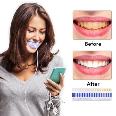 Blue Light Dental Whitening Gel