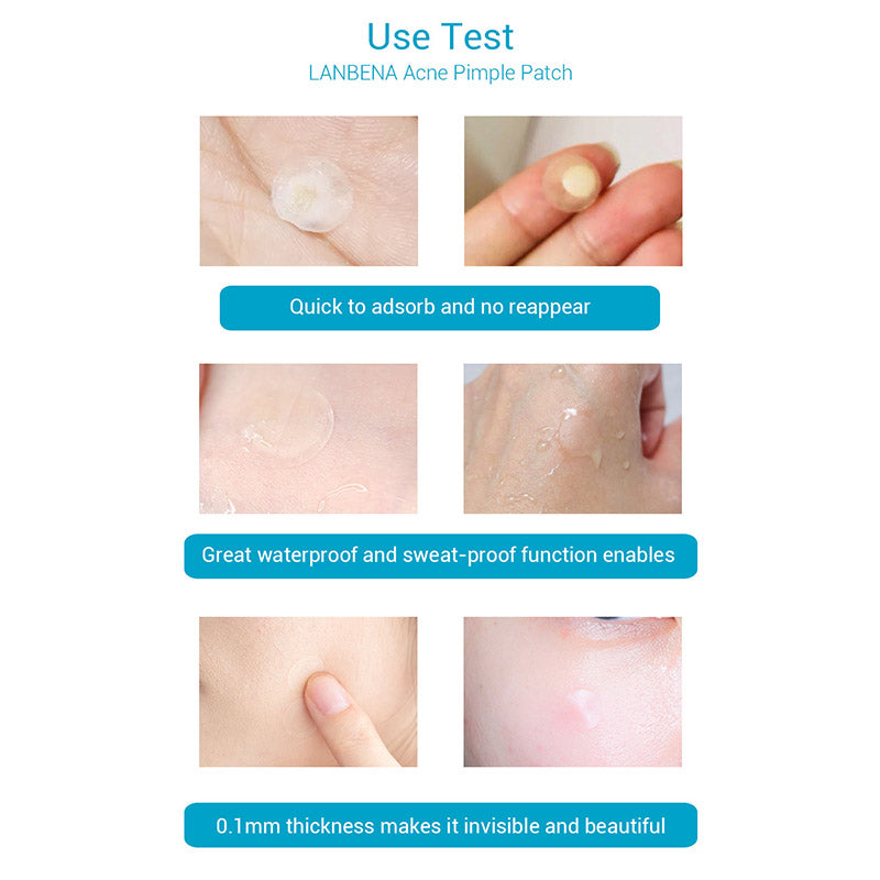 Remover Pimple Acne Stickers Patch