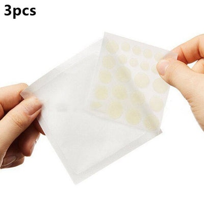 Remover Pimple Acne Stickers Patch