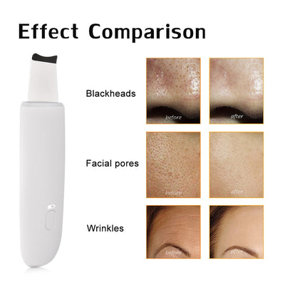 Deep Facial Cleansing Vibrator Massage